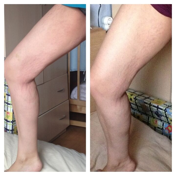 коленото пред и потоа